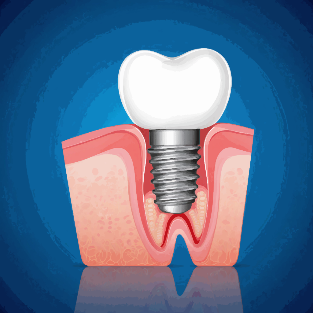Изображение маленького импланта