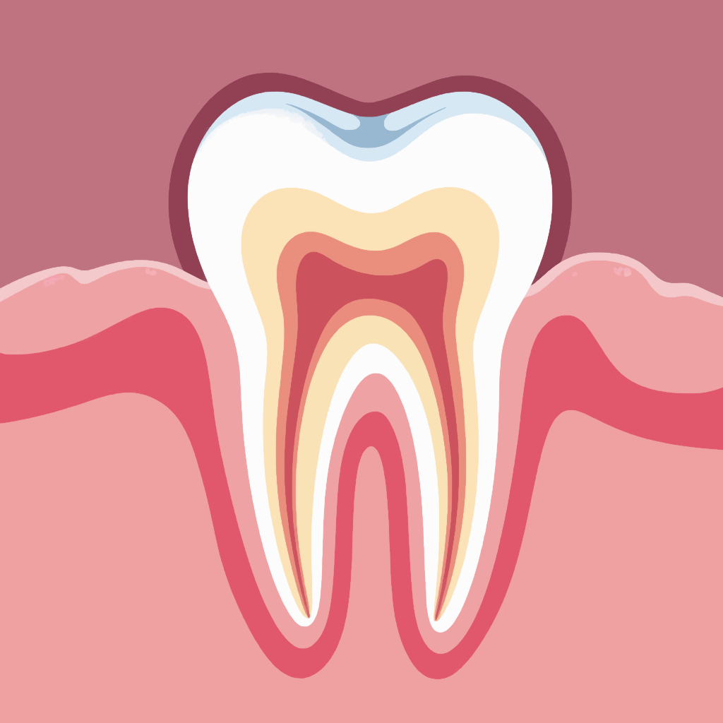 Изображение пародонтита