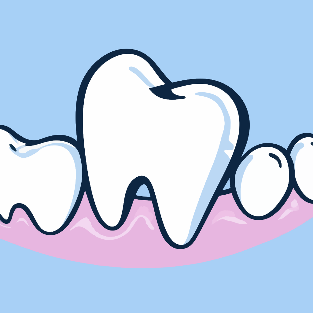 Изображение выпирающего зуба